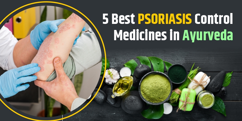 psoriasis-control-medicines-in-ayurveda